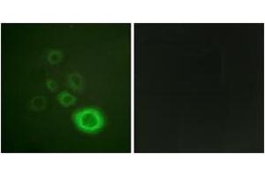 Immunofluorescence analysis of HepG2 cells, using c-Met (Phospho-Tyr1003) Antibody. (c-MET 抗体  (pTyr1003))