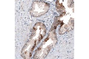 Immunohistochemical staining of human prostate shows moderate cytoplasmic positivity in glandular cells.