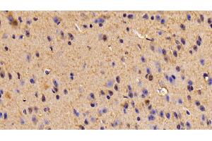 Detection of TUBb6 in Mouse Cerebrum Tissue using Polyclonal Antibody to Tubulin Beta 6 (TUBb6) (TUBb6 抗体  (AA 194-421))