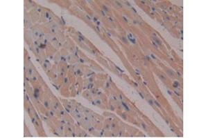 DAB staining on IHC-P Samples:Mouse Heart Tissue) (beta-2 Microglobulin 抗体  (AA 22-119))