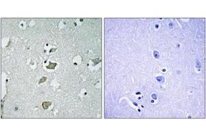 Immunohistochemistry analysis of paraffin-embedded human brain tissue, using KCNJ2 Antibody.