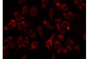 ABIN6274787 staining COLO205 by IF/ICC. (ABHD11 抗体  (C-Term))