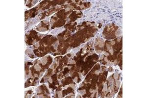 Immunohistochemical staining of human stomach with VKORC1 polyclonal antibody  shows strong cytoplasmic positivity in glandular cells. (VKORC1 抗体)