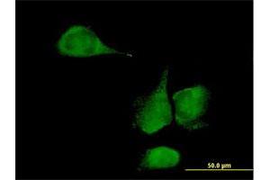 Immunofluorescence of purified MaxPab antibody to KLHDC4 on HeLa cell. (KLHDC4 抗体  (AA 1-520))