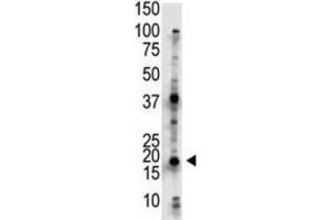 Western Blotting (WB) image for anti-Ubiquitin-Conjugating Enzyme E2G 2 (UBE2G2) antibody (ABIN3001458) (UBE2G2 抗体)