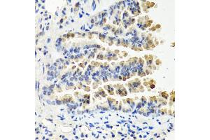 Immunohistochemistry of paraffin-embedded mouse lung using NTF3 antibody (ABIN6290616) at dilution of 1:100 (40x lens). (Neurotrophin 3 抗体)