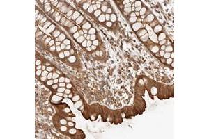 Immunohistochemical staining of human rectum with UFSP1 polyclonal antibody  shows strong cytoplasmic an membranous positivity in glandular cells. (UFSP1 抗体)