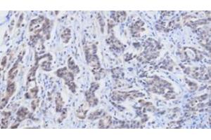 Immunohistochemistry (IHC) image for anti-Retinol Binding Protein 4, Plasma (RBP4) (AA 19-201) antibody (ABIN356230) (RBP4 抗体  (AA 19-201))