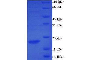 SDS-PAGE (SDS) image for Matrix Metallopeptidase 7 (Matrilysin, Uterine) (MMP7) (AA 98-267) protein (GST tag) (ABIN5709949) (MMP7 Protein (AA 98-267) (GST tag))