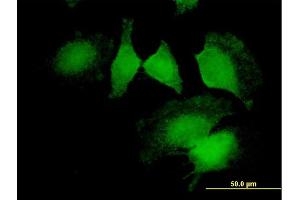 Immunofluorescence of purified MaxPab antibody to CNN2 on HeLa cell. (CNN2 抗体  (AA 1-270))