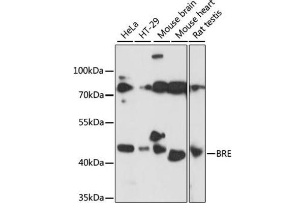 BRE 抗体  (AA 51-229)