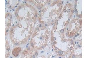 Immunohistochemistry (IHC) image for anti-Ornithine Aminotransferase (OAT) (AA 1-301) antibody (ABIN7441106)