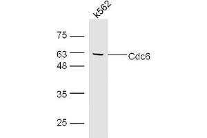 K562 cell lysates probed with Rabbit Anti-Cdc6 Polyclonal Antibody, Unconjugated  at 1:500 for 90 min at 37˚C. (CDC6 抗体)