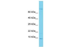 Host: Rabbit Target Name: GAGE6 Sample Type: ACHN Whole cell lysates Antibody Dilution: 1. (GAGE6 抗体  (C-Term))
