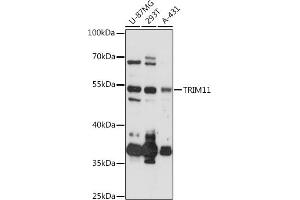 Western blot analysis of extracts of various cell lines, using TRIM11 antibody (ABIN6132732, ABIN6149500, ABIN6149501 and ABIN6218047) at 1:3000 dilution. (TRIM11 抗体  (AA 267-468))