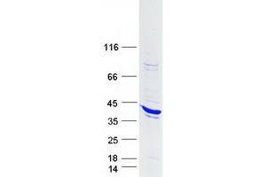 Western Blotting (WB) image for Signal Transducing Adaptor Family Member 1 (STAP1) protein (Myc-DYKDDDDK Tag) (ABIN2732759)