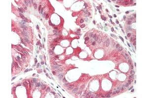 Human Colon: Formalin-Fixed, Paraffin-Embedded (FFPE), at a concentration of 5 ug/ml. (CD320 抗体  (AA 153-182))