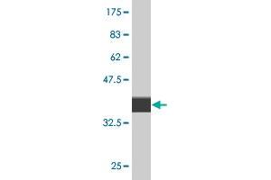 Western Blot detection against Immunogen (36. (CLIC5 抗体  (AA 91-190))