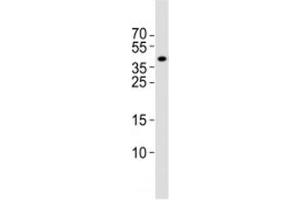Western blot analysis of lysate from rat brain tissue lysate using Isl1 antibody at 1:1000. (ISL1 抗体  (C-Term))
