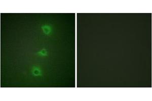 Immunofluorescence analysis of HUVEC cells, using B-RAF antibody. (SNRPE 抗体  (Internal Region))