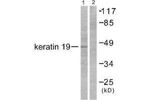 Western blot analysis of extracts from LOVO cells, using Keratin 19 antibody (ABIN5976439). (Cytokeratin 19 抗体  (Internal Region))
