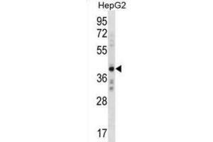 Western Blotting (WB) image for anti-AE Binding Protein 2 (AEBP2) antibody (ABIN3000396) (AEBP2 抗体)