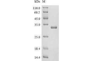 Peroxiredoxin 6 (PRDX6) (AA 2-224), (full length) protein (His tag)