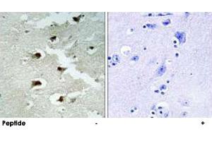 Immunohistochemistry analysis of paraffin-embedded human brain tissue using CDCA4 polyclonal antibody . (CDCA4 抗体)