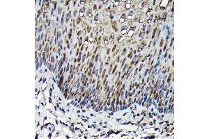 Immunohistochemistry (IHC) image for anti-Ribosomal Protein L23A (RPL23A) (AA 1-156) antibody (ABIN1682576)