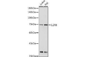 Western blot analysis of extracts of various cell lines, using IL2RB antibody (ABIN6127567, ABIN6142376, ABIN6142377 and ABIN6221796) at 1:500 dilution. (IL2 Receptor beta 抗体  (AA 27-240))