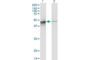 Western Blot analysis of DAZAP1 expression in transfected 293T cell line by DAZAP1 monoclonal antibody (M03), clone 2F6. (DAZAP1 抗体  (AA 308-407))