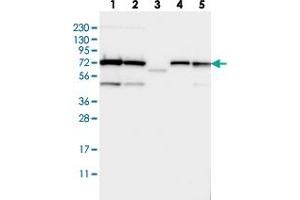Western blot analysis of Lane 1: RT-4, Lane 2: U-251 MG, Lane 3: Human Plasma, Lane 4: Liver, Lane 5: Tonsil with TRIOBP polyclonal antibody  at 1:250-1:500 dilution. (TRIOBP 抗体)