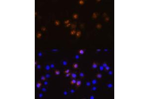 Immunofluorescence analysis of L929 cells using SW antibody (ABIN7270654) at dilution of 1:100. (SWAP70 抗体  (AA 316-585))