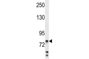 Anti-Myeloperoxidase antibody western blot analysis in MDA-MB231 lysate. (Myeloperoxidase 抗体  (AA 420-448))