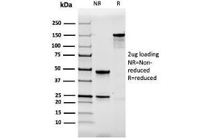 SDS-PAGE Analysis Purified Calbindin 1 Mouse Monoclonal Antibody (CALB1/2364). (CALB1 抗体  (AA 7-96))