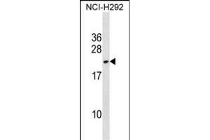 DYDC2 Antibody (C-term) (ABIN1536711 and ABIN2850314) western blot analysis in NCI- cell line lysates (35 μg/lane).