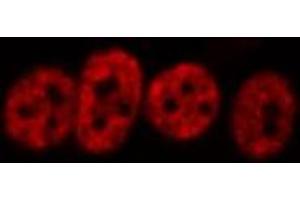 ABIN6266456 staining HeLa  cells by IF/ICC. (HNRNPD/AUF1 抗体  (pSer83))