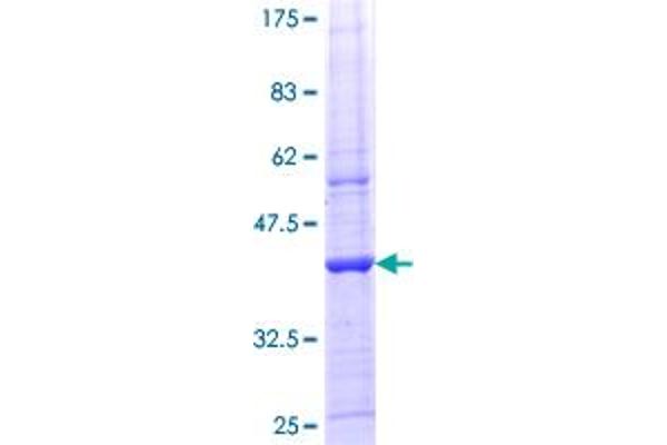 Lipin 1 Protein (LPIN1) (AA 792-890) (GST tag)