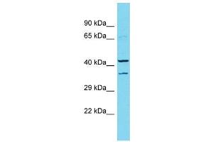 Host:  Rabbit  Target Name:  Dmbx1  Sample Type:  Rat Pancreas lysates  Antibody Dilution:  1. (DMBX1 抗体  (Middle Region))