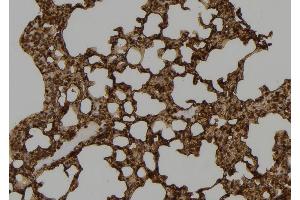 ABIN6277493 at 1/100 staining Mouse lung tissue by IHC-P. (SETD8 抗体  (Internal Region))