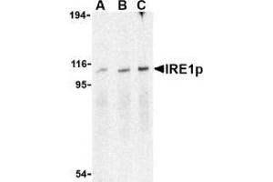 Western blot analysis of IRE1p in A-20 cell lysate with AP30444PU-N IRE1p antibody at (A), 0.