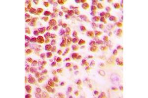 Immunohistochemical analysis of c-Myb staining in human tonsil formalin fixed paraffin embedded tissue section. (MYB 抗体  (N-Term))