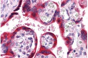 Immunohistochemistry (Formalin-fixed Paraffin-embedded Sections) (IHC (fp)) image for anti-ATPase, H+ Transporting, Lysosomal 34kDa, V1 Subunit D (ATP6V1D) (AA 69-169) antibody (ABIN574451)