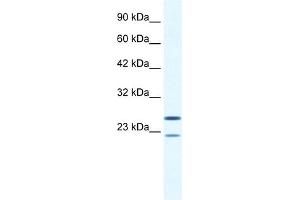 WB Suggested Anti-TRIM14 Antibody Titration:  0. (TRIM14 抗体  (N-Term))