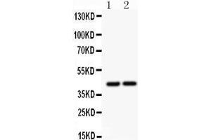 Anti- RUNX3 antibody, Western blotting All lanes: Anti RUNX3  at 0. (RUNX3 抗体  (Middle Region))