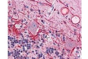 Immunohistochemistry of Mouse anti-AKT pT308 antibody. (AKT1 抗体  (pThr308))