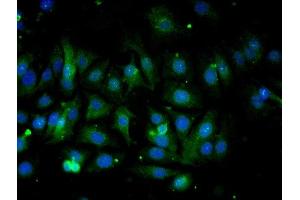 Validation submitted by One World Lab. (COX IV 抗体  (AA 51-169))