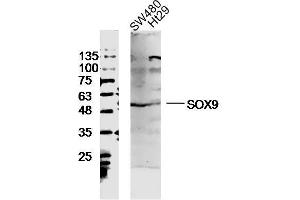 SW480 and Ht29 lysates probed with SOX9 Polyclonal Antibody, unconjugated  at 1:300 overnight at 4°C followed by a conjugated secondary antibody at 1:10000 for 90 minutes at 37°C. (SOX9 抗体  (AA 121-220))