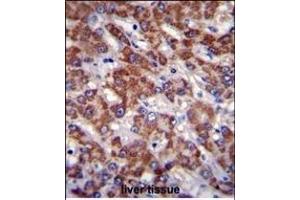 OR2B11 Antibody (C-term) (ABIN655367 and ABIN2844924) immunohistochemistry analysis in formalin fixed and paraffin embedded human liver tissue followed by peroxidase conjugation of the secondary antibody and DAB staining. (OR2B11 抗体  (C-Term))