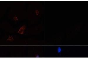 Immunofluorescence analysis of 293T cells using ACACA Polyclonal Antibody at dilution of 1:100. (Acetyl-CoA Carboxylase alpha 抗体)